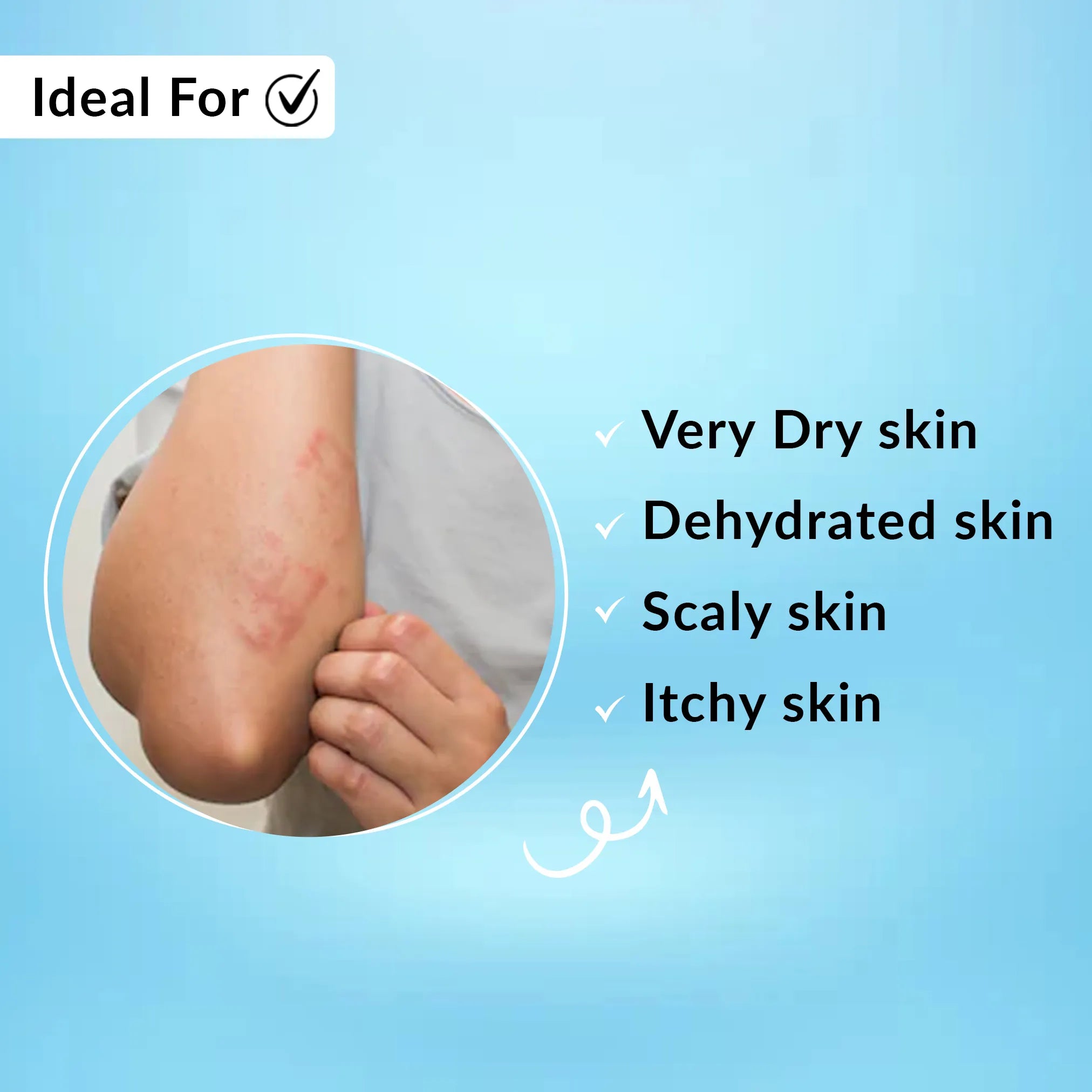 Fidelia Hydrating Body Lotion | Intensive Body Lotion to Revitalize Dry & Scaly Skin