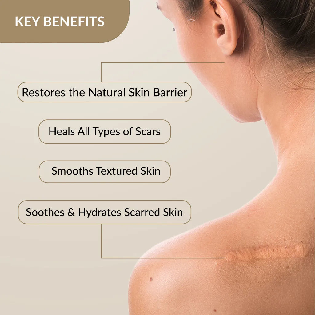 Kelocepa Silicone Gel, 25 ml | Treats and Heals All Types of Scars