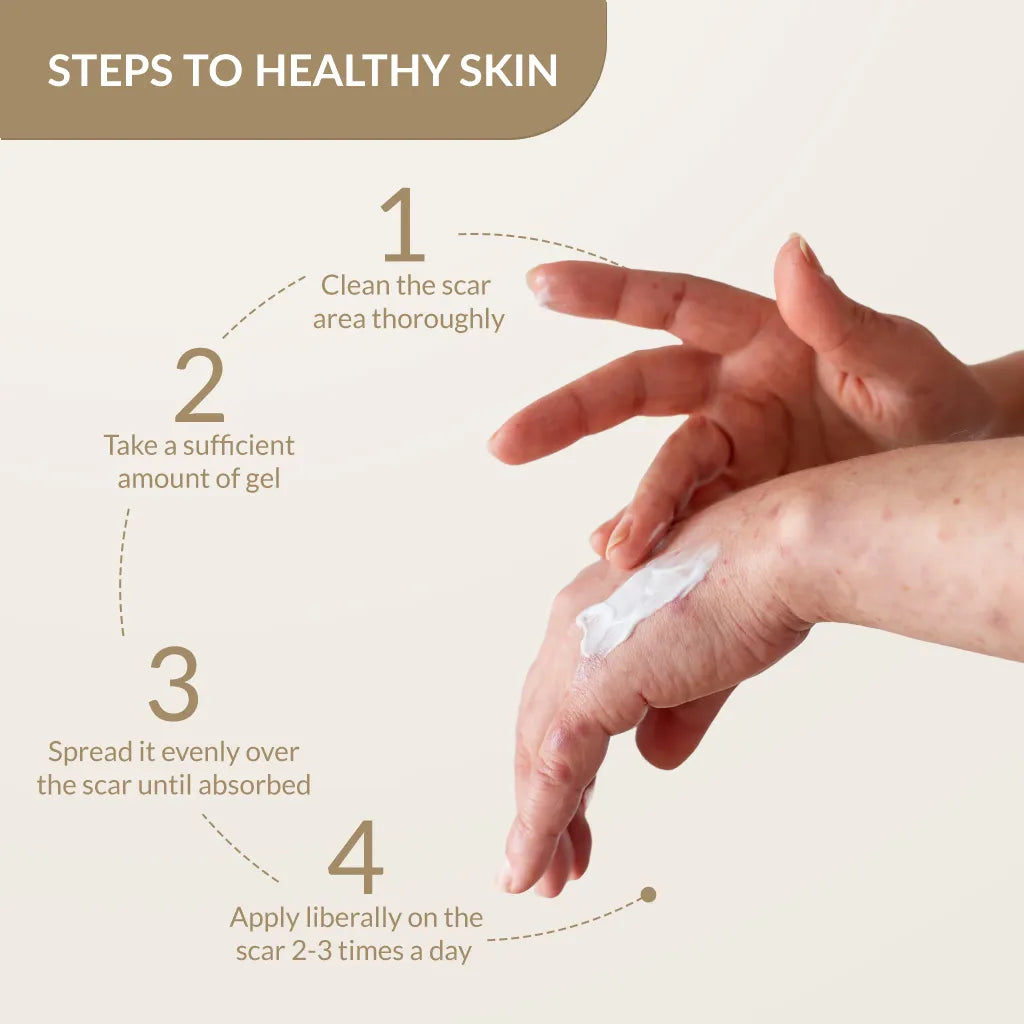 Kelocepa Silicone Gel, 25 ml | Treats and Heals All Types of Scars