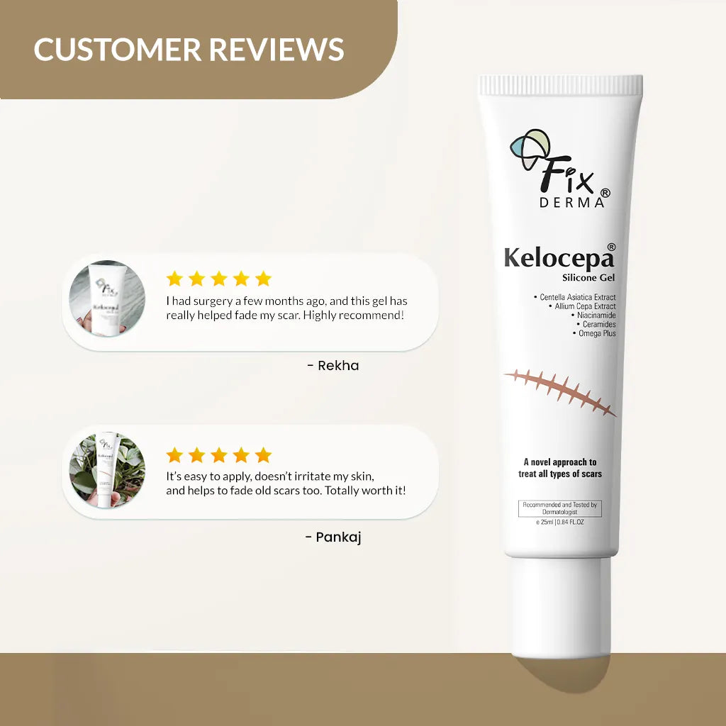 Kelocepa Silicone Gel, 25 ml | Treats and Heals All Types of Scars