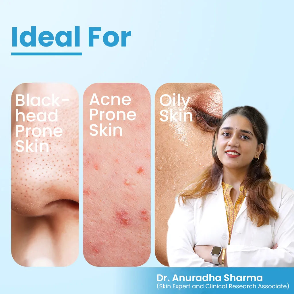 FCL Alpha Beta Acne Gel | 30 ml |  Salicylic & Glycolic Acid – Clears Breakouts & Unclogs Pores